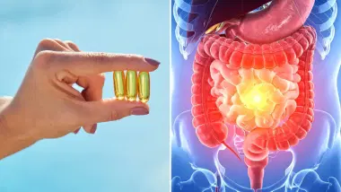 La vitamina D podría ayudar a regular la respuesta inmunitaria en personas con enfermedad inflamatoria intestinal